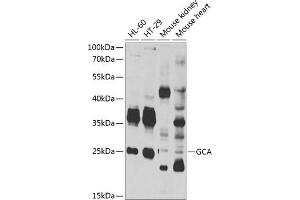 Western blot analysis of extracts of various cell lines, using GCA antibody (ABIN6131692, ABIN6141005, ABIN6141006 and ABIN6222887) at 1:1000 dilution. (Grancalcin 抗体  (AA 1-217))