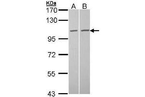 WB Image Sample (30 ug of whole cell lysate) A: A431 , B: Hela 7. (TUBGCP2 抗体  (N-Term))