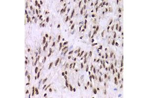 Immunohistochemistry of paraffin-embedded human leiomyoma of uterus using XRCC6 Antibody.