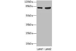Western blot All lanes: TARS antibody at 4. (TARS 抗体  (AA 1-230))