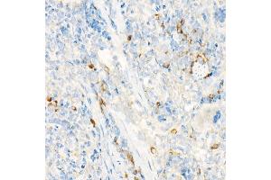 Immunohistochemistry of paraffin-embedded rat spleen using IL27RA Rabbit pAb (ABIN6128083, ABIN6142374, ABIN6142375 and ABIN6224203) at dilution of 1:25 (40x lens). (IL27 Receptor alpha 抗体  (AA 33-283))