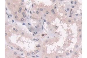 Immunohistochemistry (IHC) image for anti-Transgelin (TAGLN) (AA 1-201) antibody (ABIN7435139)