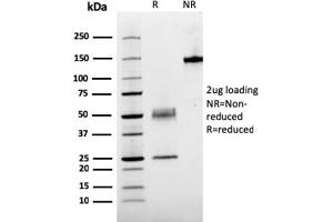 SDS-PAGE Analysis Purified PTH Mouse Recombinant Monoclonal Antibody (rPTH/911). (Recombinant PTH 抗体  (AA 1-34))