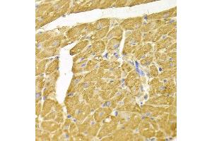 Immunohistochemistry of paraffin-embedded rat heart using NDRG1 antibody at dilution of 1:100 (x400 lens). (NDRG1 抗体)