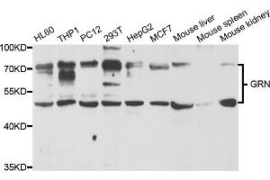 Western blot analysis of extracts of various cell lines, using GRN antibody. (Granulin 抗体)