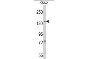 Western blot analysis of hAGL-C371 in K562 cell line lysates (35ug/lane) (AGL 抗体  (AA 357-387))