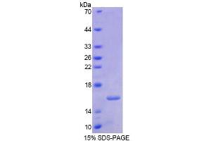 SDS-PAGE analysis of Human RARa Protein. (Retinoic Acid Receptor alpha 蛋白)