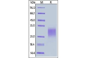SDS-PAGE (SDS) image for T Cell Immunoreceptor with Ig and ITIM Domains (TIGIT) (AA 17-208) (Active) protein (His tag) (ABIN6809851)