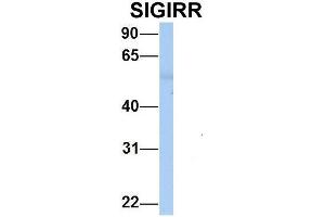 Host:  Rabbit  Target Name:  SIGIRR   Sample Type:  Human Adult Placenta  Antibody Dilution:  1.