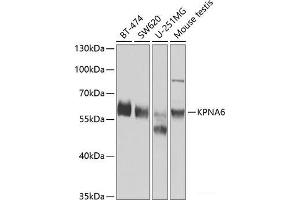 Western blot analysis of extracts of various cell lines using KPNA6 Polyclonal Antibody at dilution of 1:1000. (KPNA6 抗体)