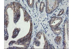 Image no. 5 for anti-Src-like-adaptor 2 (SLA2) antibody (ABIN1500948)