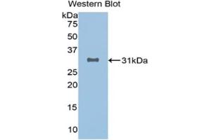 Detection of Recombinant SIRT3, Human using Monoclonal Antibody to Sirtuin 3 (SIRT3)