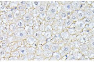 Immunohistochemistry of paraffin-embedded Rat liver using SPTAN1 Polyclonal Antibody at dilution of 1:100 (40x lens). (SPTAN1 抗体)