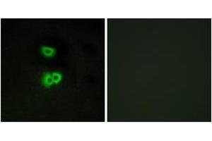 Immunofluorescence analysis of A549 cells, using GPR101 Antibody. (GPR101 抗体  (AA 245-294))