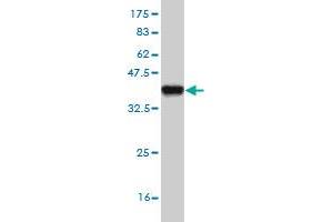 Western Blot detection against Immunogen (37. (DPYD 抗体  (AA 1-110))