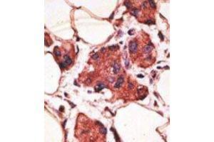 Image no. 2 for anti-Melanoma Antigen Family A, 9 (MAGEA9) (Middle Region) antibody (ABIN358651) (MAGEA9 抗体  (Middle Region))