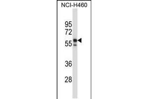 Western blot analysis in NCI-H460 cell line lysates (35ug/lane). (Keratin 6B 抗体  (AA 207-236))