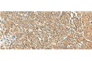 Immunohistochemistry of paraffin-embedded Human tonsil tissue using GRIPAP1 Polyclonal Antibody at dilution of 1:50(x200) (GRIPAP1 抗体)
