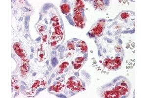 Anti-TBKBP1 antibody IHC of human placenta. (TBKBP1 抗体  (AA 300-350))
