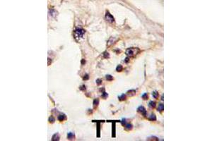 Formalin-fixed and paraffin-embedded human testis tissue reacted with TESK2 polyclonal antibody  , which was peroxidase-conjugated to the secondary antibody, followed by DAB staining. (TESK2 抗体  (Internal Region))