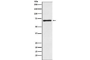 Western blot analysis of GABA Transporter 1 / GAT 1 expression in Human fetal brain lysate.