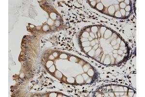 Immunoperoxidase of monoclonal antibody to TUBB2A on formalin-fixed paraffin-embedded human colon. (TUBB2A 抗体  (AA 1-445))