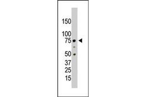 The PRMT5 polyclonal antibody  is used in Western blot to detect PRMT5 in HL-60 cell lysate. (PRMT5 抗体  (C-Term))