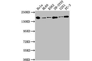Western Blot Positive WB detected in: Hela whole cell lysate, HL60 whole cell lysate, K562 whole cell lysate, SH-SY5Y whole cell lysate, U251 whole cell lysate, PC-3 whole cell lysate All lanes: DOT1L antibody at 1:1500 Secondary Goat polyclonal to rabbit IgG at 1/50000 dilution Predicted band size: 165, 185 kDa Observed band size: 185 kDa