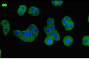 Immunofluorescent analysis of HepG2 cells using ABIN7145231 at dilution of 1:100 and Alexa Fluor 488-congugated AffiniPure Goat Anti-Rabbit IgG(H+L) (BBS1 抗体  (AA 217-417))