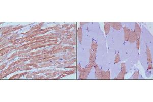 Immunohistochemical analysis of paraffin-embedded human skeletal muscle (left) and cardiac muscle (right) using MYL3 mouse mAb with DAB staining. (MYL3/CMLC1 抗体)
