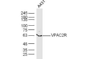 A431 lysates probed with VPAC2R Polyclonal Antibody, Unconjugated  at 1:300 dilution and 4˚C overnight incubation. (VIPR2 抗体  (AA 81-170))