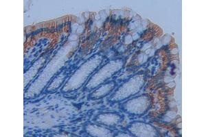 Used in DAB staining on fromalin fixed paraffin- embedded Kidney tissue (CD7 抗体  (AA 24-150))
