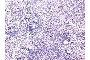 IHC analysis of cortactin using anti-cortactin antibody (ABIN6719306). (Cortactin 抗体  (AA 1-105))