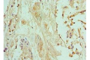 Immunohistochemistry of paraffin-embedded human prostate tissue using ABIN7145331 at dilution of 1:100 (BNIP3 抗体  (AA 1-164))
