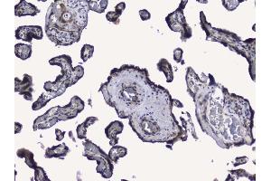 IHC analysis of RALBP1 using anti-RALBP1 antibody (ABIN5692936). (RALBP1 抗体  (AA 239-506))