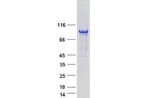 Western Blotting (WB) image for rho GTPase Activating Protein 6 (ARHGAP6) (Transcript Variant 4) protein (Myc-DYKDDDDK Tag) (ABIN2714884)