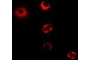 Immunofluorescent analysis of CPT1A staining in MCF7 cells. (CPT1A 抗体)