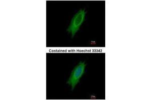 ICC/IF Image Immunofluorescence analysis of methanol-fixed HeLa, using HLA-DPA1, antibody at 1:500 dilution. (HLA-DPA1 抗体)