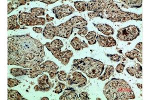Immunohistochemical analysis of paraffin-embedded human-placenta, antibody was diluted at 1:200 (VEGFR2/CD309 抗体  (AA 1268-1341))