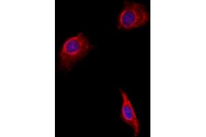 ABIN6257551 and ABIN6275682 staining HepG2 by IF/ICC. (WASF2 抗体  (Internal Region))