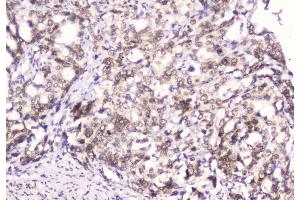 IHC analysis of Emerin using anti-Emerin antibody (ABIN5692852).