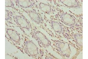 Immunohistochemistry of paraffin-embedded human colon tissue using ABIN7173261 at dilution of 1:100 (TMEM65 抗体  (AA 63-240))