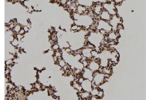 ABIN6269224 at 1/100 staining Mouse lung tissue by IHC-P.