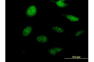 Immunofluorescence of purified MaxPab antibody to NKX2-8 on HeLa cell. (NKX2-8 抗体  (AA 1-239))