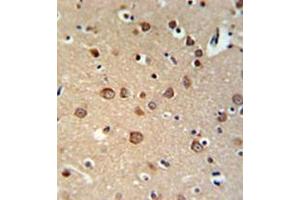 Immunohistochemistry (Paraffin-embedded Sections) (IHC (p)) image for anti-phosphodiesterase 6C, CGMP-Specific, Cone, alpha Prime (PDE6C) (AA 278-308), (Middle Region) antibody (ABIN954067)