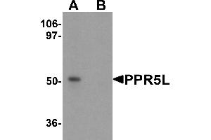 Western blot analysis of PRR5L in 3T3 cell lysate with PRR5L antibody at 1 µg/mL in (A) the absence and (B) the presence of blocking peptide