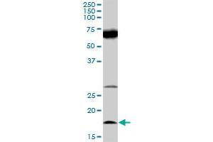 Western Blotting (WB) image for anti-Interleukin 21 (IL21) (AA 1-162) antibody (ABIN528381)