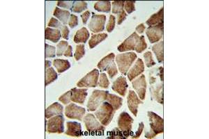 Formalin-fixed and paraffin-embedded human skeletal muscle reacted with ATP5C1 Antibody (N-term), which was peroxidase-conjugated to the secondary antibody, followed by DAB staining. (ATP5C1 抗体  (N-Term))