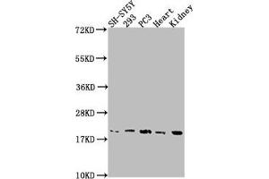 Western Blot Positive WB detected in: SH-SY5Y whole cell lysate, 293 whole cell lysate, PC3 whole cell lysate, Mouse heart tissue, Mouse kidney tissue All lanes: PYCARD antibody at 1:2000 Secondary Goat polyclonal to rabbit IgG at 1/50000 dilution Predicted band size: 22, 20, 16 kDa Observed band size: 20 kDa (PYCARD 抗体  (AA 1-195))