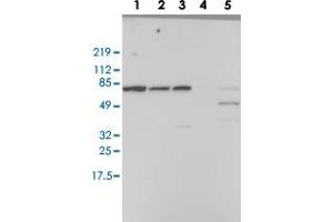 Western blot analysis of Lane 1: RT-4, Lane 2: EFO-21, Lane 3: A-431, Lane 4: Liver, Lane 5: Tonsil with RBM39 polyclonal antibody  at 1:100-1:250 dilution. (RBM39 抗体)
